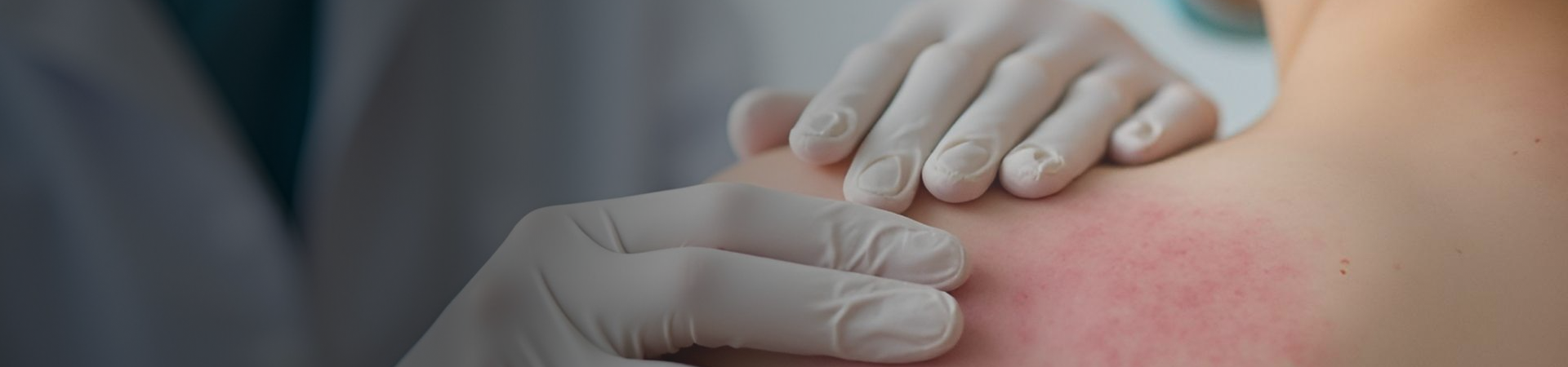 Dermatology